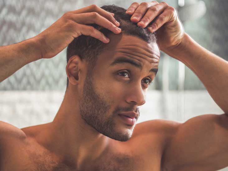 Why do men go bald?
