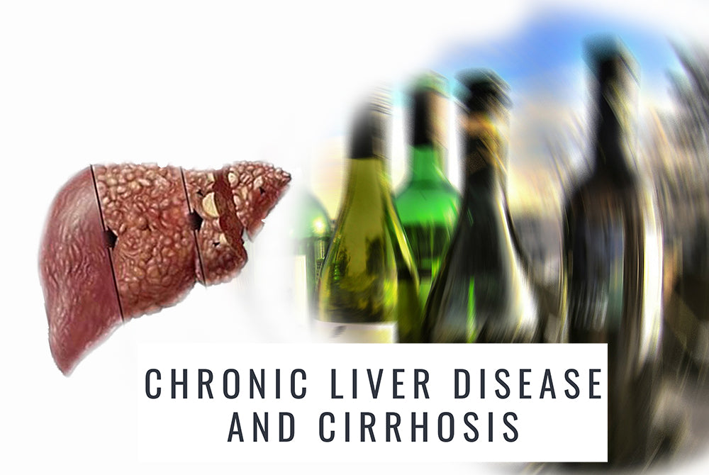 Chronic liver disease and cirrhosis