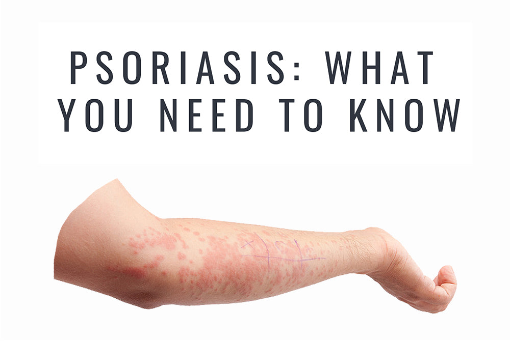 Psoriasis - What you need to know