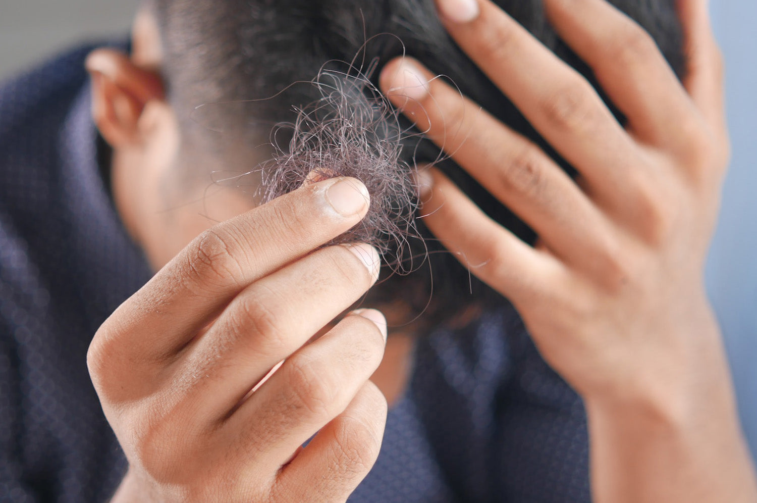 10 Common causes of hair loss