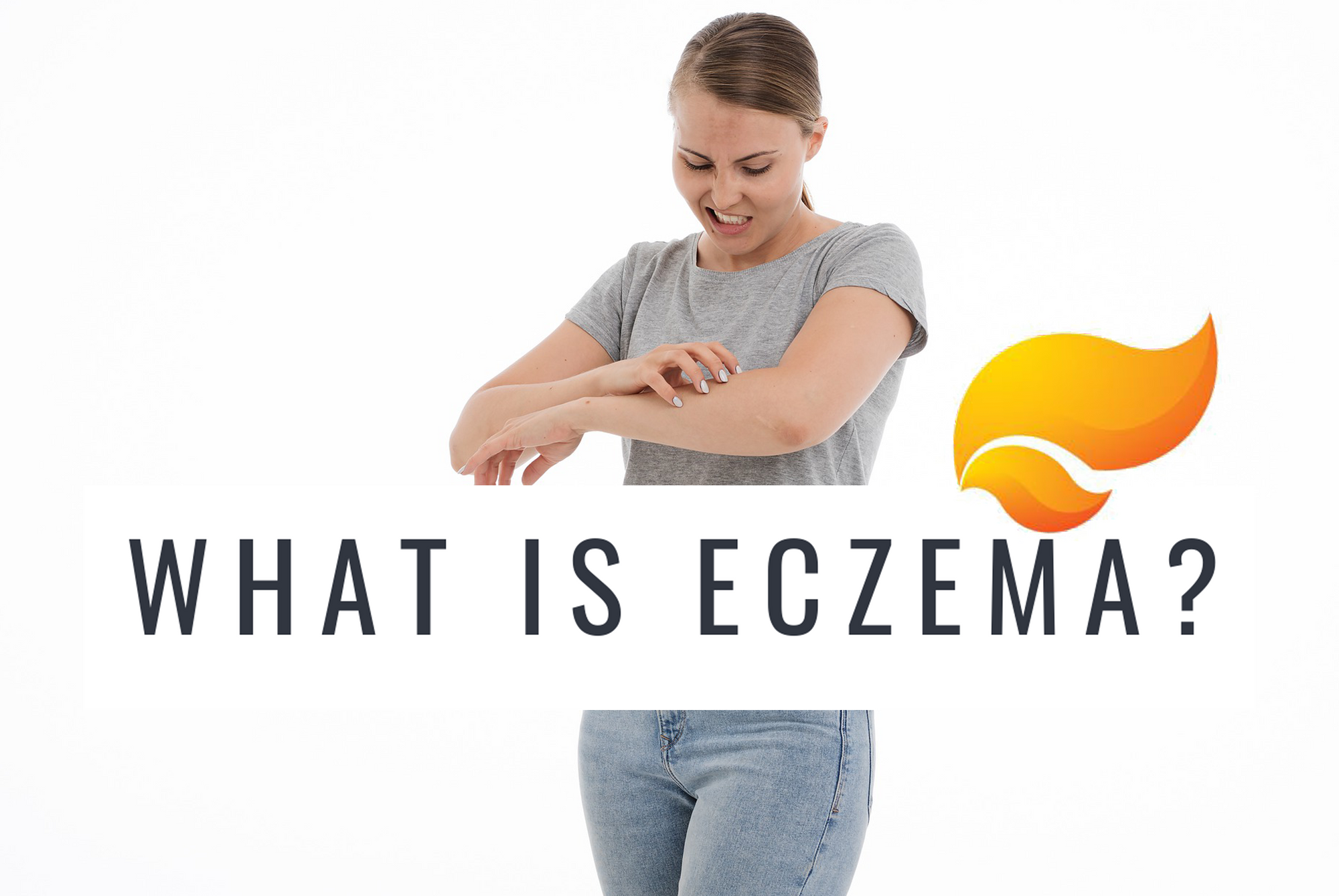 WHAT IS ECZEMA?