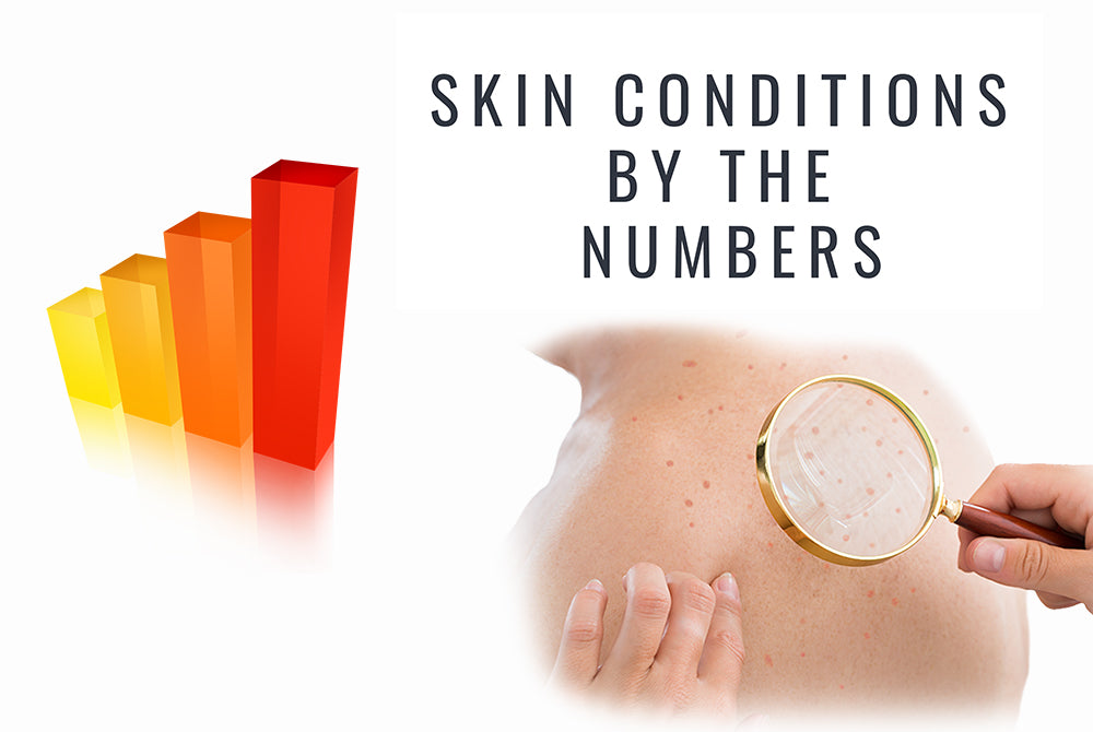 Skin conditions by the numbers